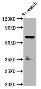 SLC5A5 Antibody