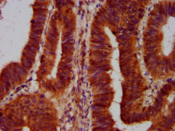 SLC5A5 Antibody