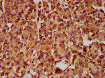 SLC5A5 Antibody