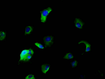SLC5A5 Antibody