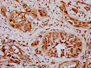 SMARCD2 Antibody