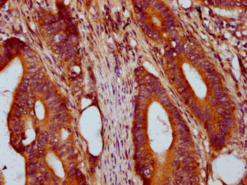 PRSS16 Antibody