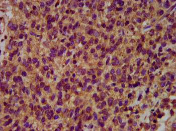 HECW2 Antibody
