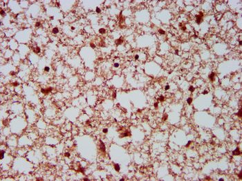 HECW2 Antibody