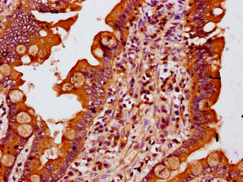 MTSS1 Antibody