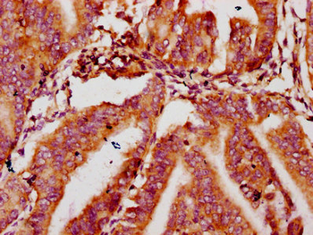 MTSS1 Antibody