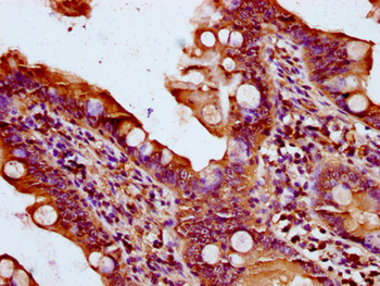 QSOX1 Antibody