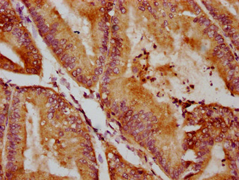 QSOX1 Antibody