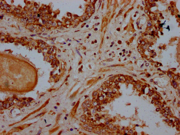 PSME4 Antibody