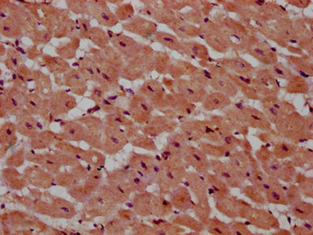 PSME4 Antibody