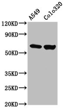 PDILT Antibody