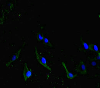 CDC73 Antibody