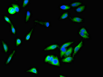 SFRP1 Antibody