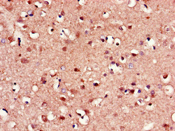 FZD8 Antibody