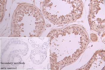 ANKRD11 Antibody