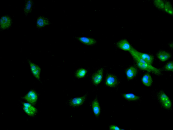 ANKRD11 Antibody