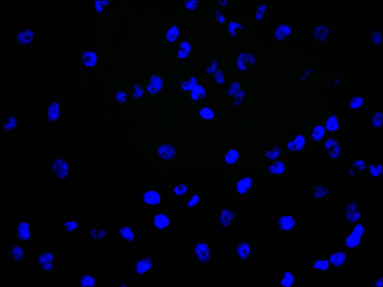 ANKRD11 Antibody