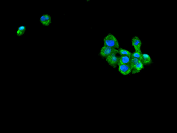 ANKRD11 Antibody
