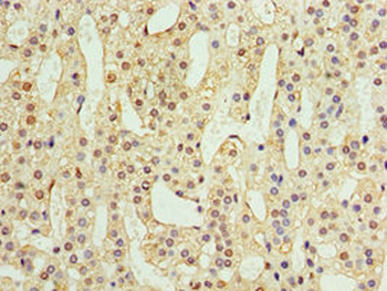 ADAP1 Antibody