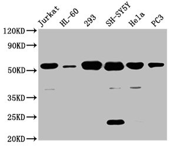 CYP21A2 Antibody