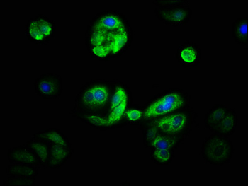CYP21A2 Antibody