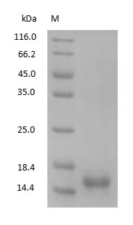 Human Cystatin-C Protein