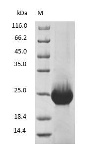 Human Retinol-Binding Protein 4