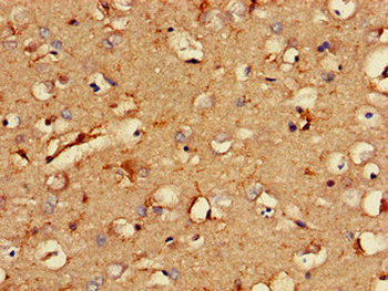 RCAN2 Antibody