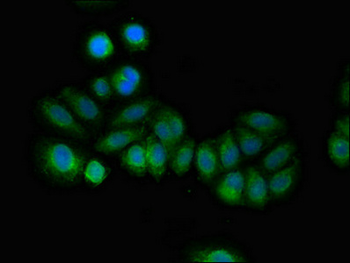 RCAN2 Antibody