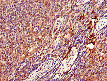 DENND1C Antibody