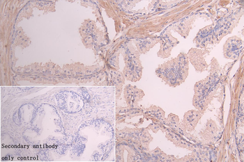 VPS39 Antibody