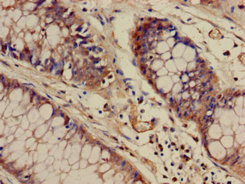 WASF1 Antibody