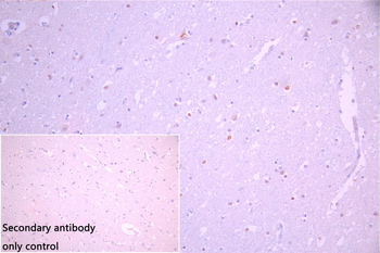 SMARCAL1 Antibody