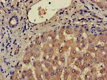 CCR3 Antibody