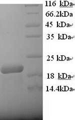 Human MS4A1 protein