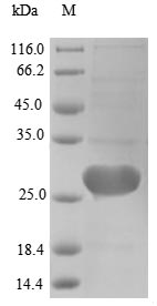 Human cDNA FLJ56323 protein