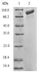 Human DGKA protein