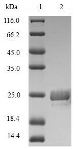 Insect Heteroscodra maculata Kappa-theraphotoxin-Hm1a protein