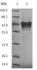 Viral A Outer capsid glycoprotein VP7 protein