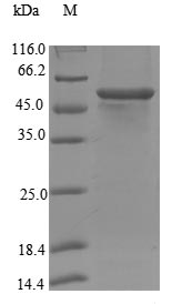 Human CYP17A1 protein
