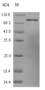 Human HDC protein