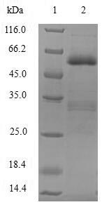 Human SIAH1 protein