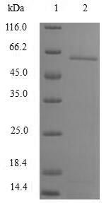 Human CNOT8 protein
