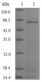 Human DFFA protein