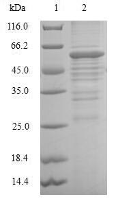 Human DHRS2 protein