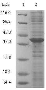 Human AHSP protein