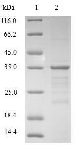 Human HMGN2 protein