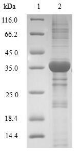 Human HMGN4 protein