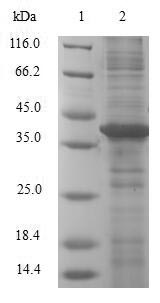 Human Galectin-2 protein