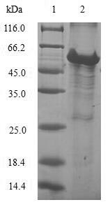 Human MRPL28 protein